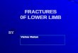 FRACTURES  0F LOWER LIMB