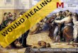 Wound healing