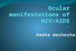 5.ocular manifestations of hiv