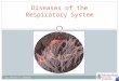respiratory infections - microbiology