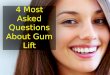 4 most asked questions about gum lift