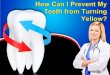 How Can I Prevent My Teeth from Turning Yellow?