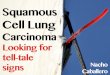 Squamous Cell Carcinoma: Looking for tale-tell signs