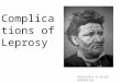 Complications of leprosy