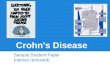 Crohn's disease2