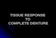 2 tissue response exam, preprosthetic