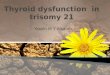 hypothyrodsim in trisomy 21