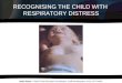 Recognising the child with respiratory distress