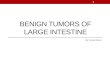 benign tumor of large intestine