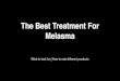 Melasma treatment