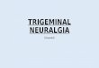 Updated trigeminal neuralgia
