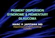 Pigment Dispersion Syndrome & Pigmentary Glaucoma