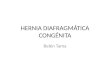 Hernia diafragmatica