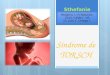 Síndrome de TORCH Pediatria I /III Rotacion 2014 / UNAHVS/ S. Matute