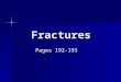 07 Fractures