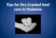 Dry Cracked heel care in diabetes- tips
