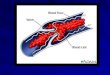 Deep vein thrombosis and Pulmonary embolism 2014