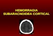 Hemorragia subaracnoidea cortical