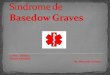 Sindrome de Basedow Graves