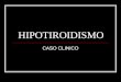 HIPOTIROIDISMO caso clinico