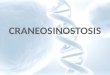 Alberto MArtinez Godoy Genetica Craneosinostosis