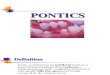 Pontics [Fixed Prosthodontics Seminar @AmCoFam]