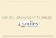 Dental Crowns at FC Smiles