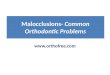 Orthodontics Malocclusions