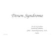 Down syndrome ppt for UGs