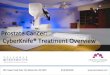 Prostate Cancer: Columbus CyberKnife Treatment Overview