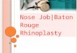 Nose job baton rouge rhinoplasty225 224 2999