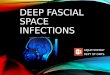 Fascial Space Inection - Part 1