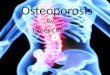 Avoid osteoporosis
