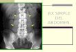 Estudio radiografico simple del abdomen. DRA MARROQUIN