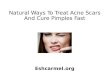 Natural ways to treat acne scars and cure