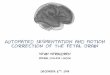 Automated segmentation and motion correction of the fetal brain