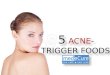 5 acne trigger foods
