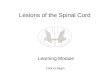 Lesions of the Spinal Cord: Learning Module