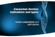 Caesarean section -  indications and types