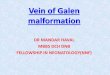 “Vein of galen Malformation” ppt