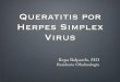 Queratitis Por Herpes Simplex Virus (HSV)