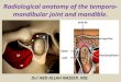 Presentation1.pptx, radiological anatomy of the temporo mandibular joint and mandibule