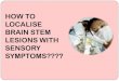 Brain stem lessions in sensory symptoms