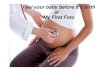 Prenatal 3d 4d ultrasound service in California