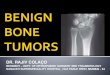 Benign tumors in orthopaedics