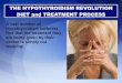 The Hypothyroidism Diet - The Hypothyroidism Revolution