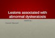 Oral lesions with dyskeratosis