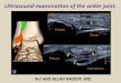 Presentation1.pptx. ultrasound examination of the ankle joint