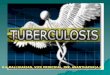 Tuberosis presentation1