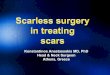 Scarless surgery in treating scars